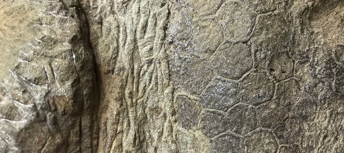 Mid-forearm skin from Dakota showing fingernail sized scales